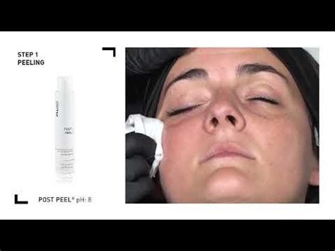 chanel injection side effects|chanel injection 135 ha.